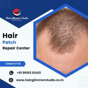 Hair-Patch-Repair-Center-in-Bangalore