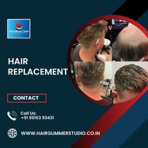 Hair-Replacement-in-Bangalore-3