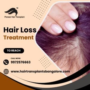 Best-Hair-Loss-Treatment-in-Bangalore-2