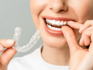 invisible-braces-cost